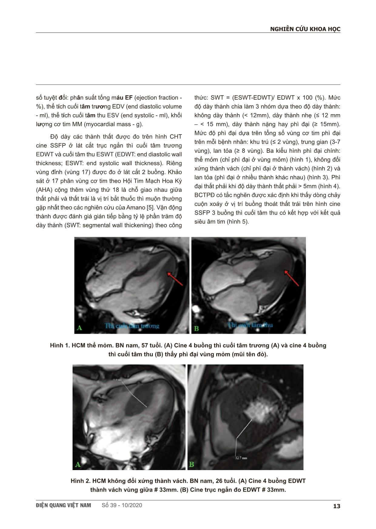 Khảo sát đặc điểm hình ảnh bắt thuốc thì muộn trên cộng hưởng từ của bệnh cơ tim phì đại trang 3
