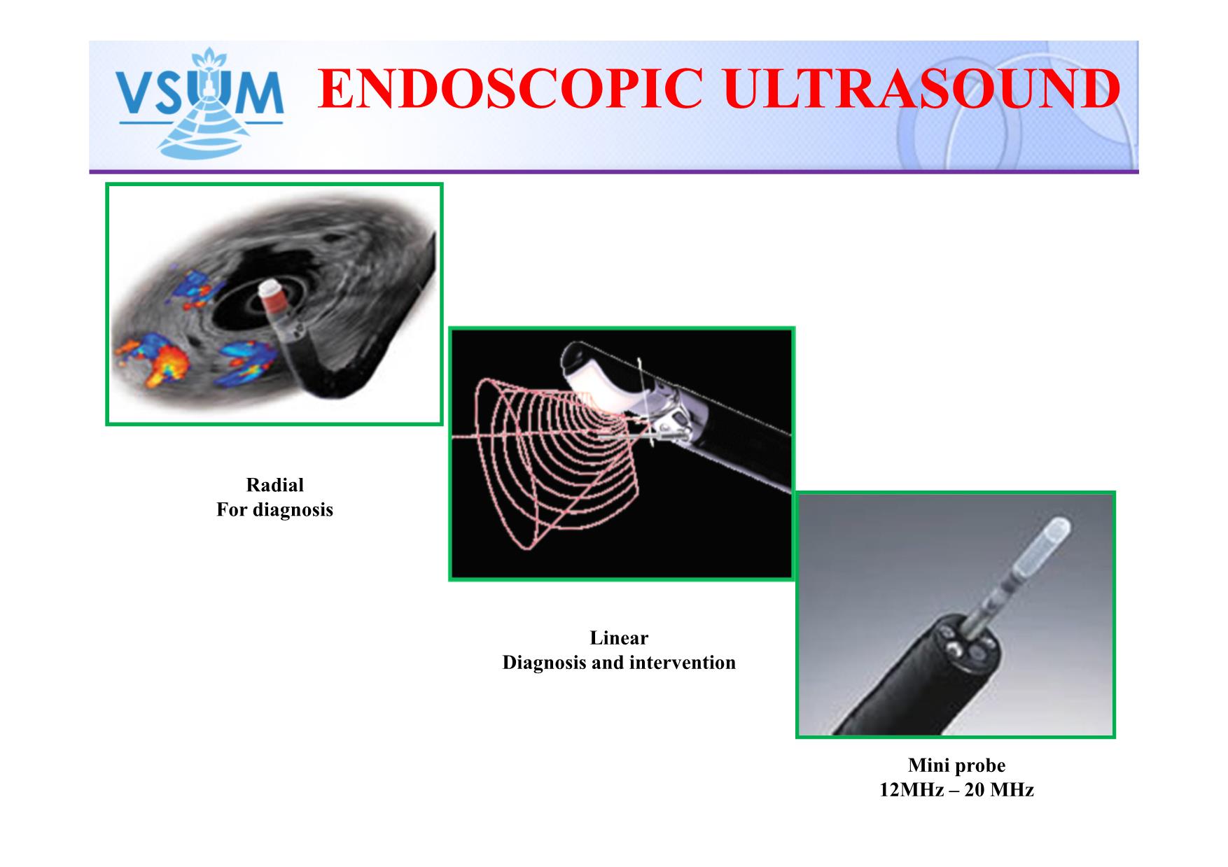 The update: endoscopic ultrasound in the diagnosis and treatment of gastroenterology disease trang 5