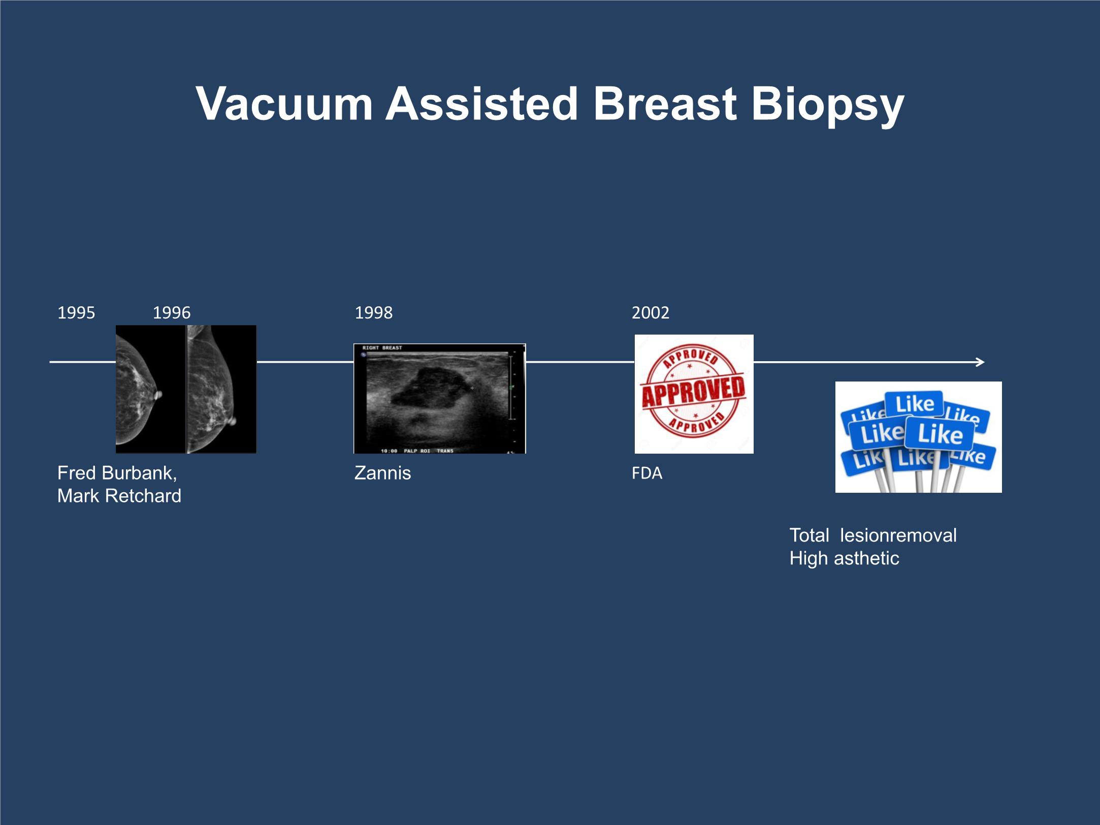 Evaluation of the initial efficacy in the removal of benign breast lesions by vacuum - Assisted biopsy in radiology center of Bach Mai hospital trang 9