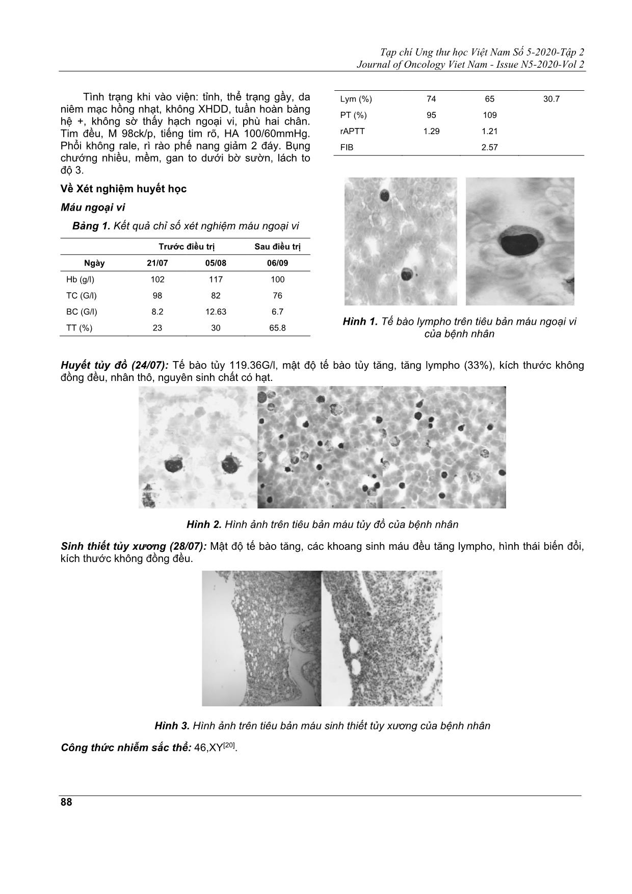 Báo cáo ca bệnh: chẩn đoán bệnh bạch cầu tế bào lympho T hạt lớn bằng kỹ thuật flow cytometry tại trung tâm huyết học và truyền máu, bệnh viện Bạch Mai trang 2