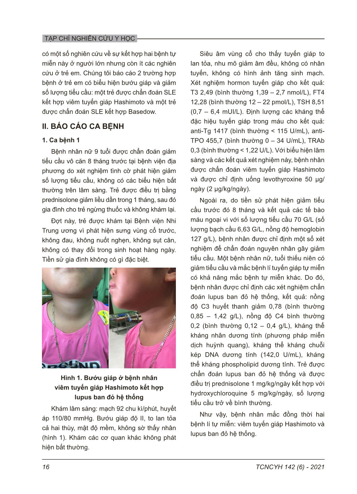 Bệnh tuyến giáp tự miễn kết hợp với lupus ban đỏ hệ thống ở trẻ em: Báo cáo 2 trường hợp trang 2