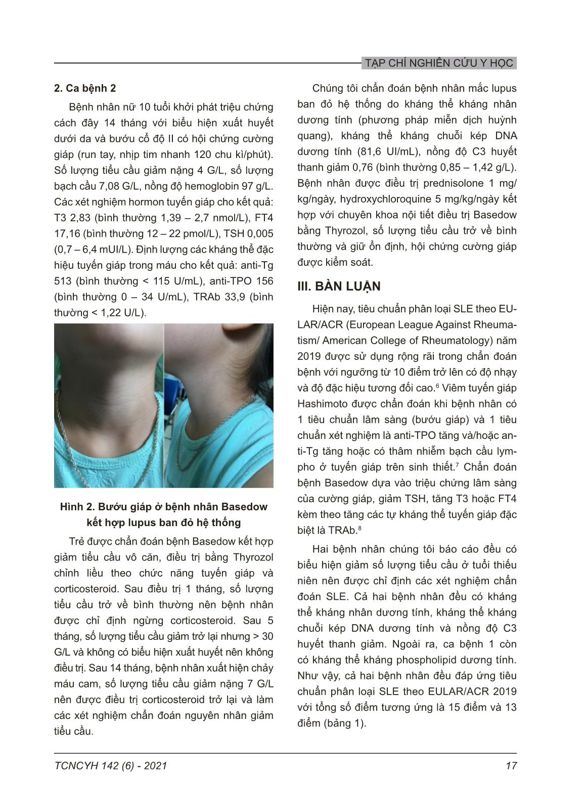 Bệnh tuyến giáp tự miễn kết hợp với lupus ban đỏ hệ thống ở trẻ em: Báo cáo 2 trường hợp trang 3