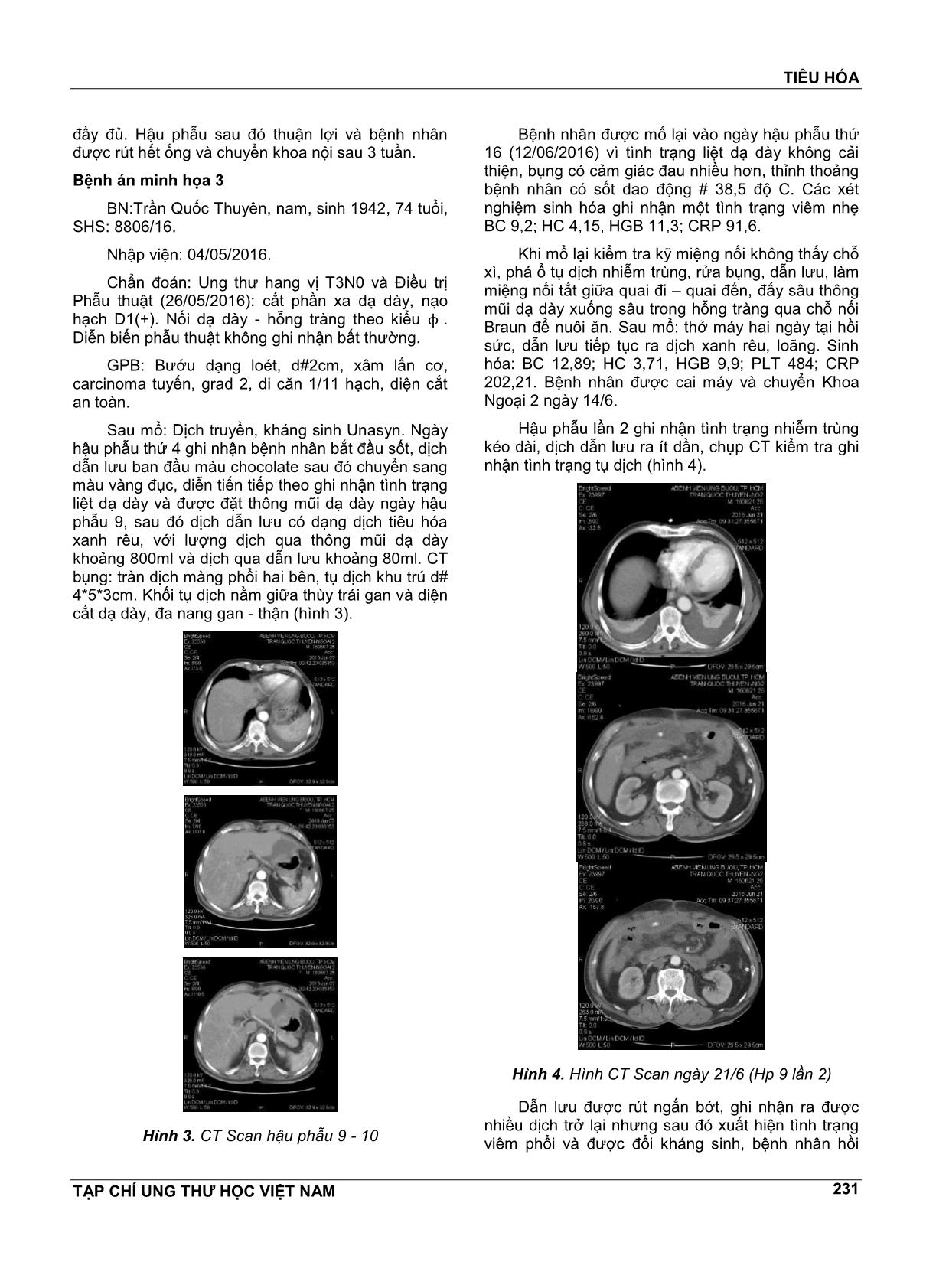 Biến chứng sớm sau phẫu thuật cắt phần xa dạ dày nối billroth II trang 3