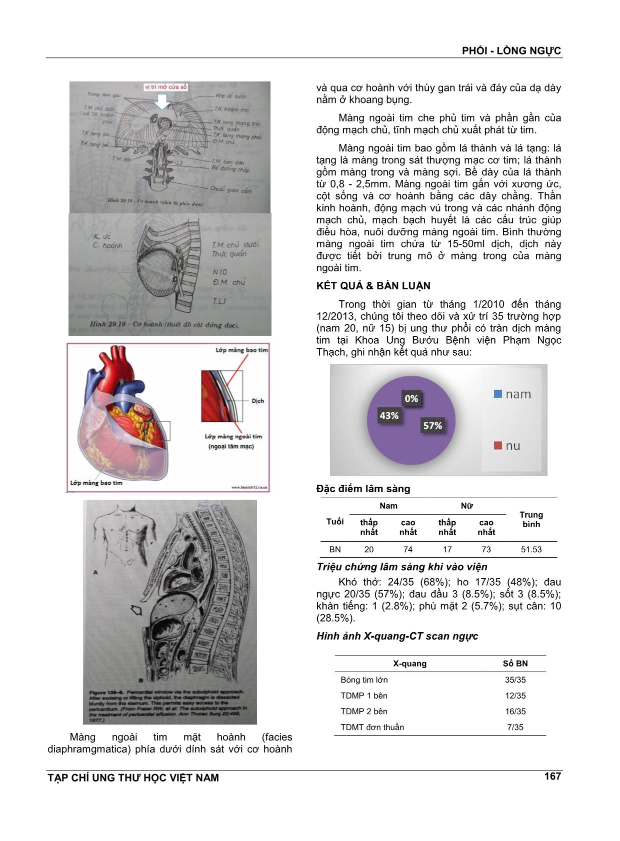 Mở cửa sổ màng ngoài tim trong điều trị tràn dịch màng ngoài tim ác tính ở bệnh nhân ung thư phổi trang 4