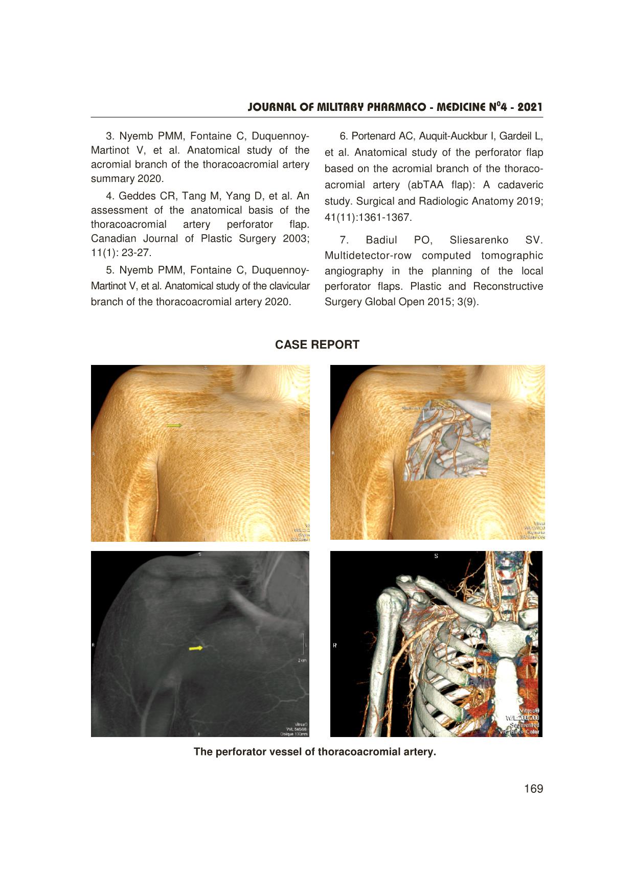 Multidetector-Row computed tomography analysis of the anatomical characteristics of thoracoacromial artery perforator trang 8