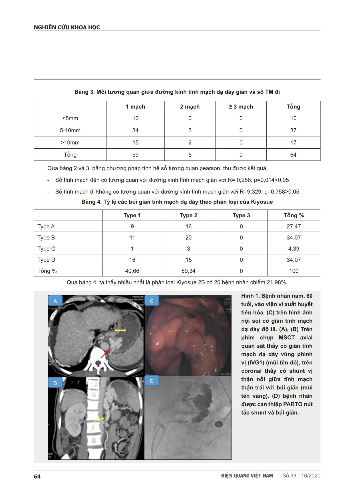 Nghiên cứu đặc điểm búi giãn tĩnh mạch dạ dày ở bệnh nhân xơ gan trên hình ảnh cắt lớp vi tính đa dãy để chỉ định can thiệp parto trang 4