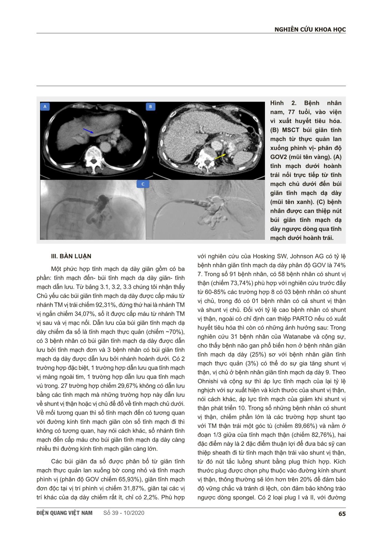 Nghiên cứu đặc điểm búi giãn tĩnh mạch dạ dày ở bệnh nhân xơ gan trên hình ảnh cắt lớp vi tính đa dãy để chỉ định can thiệp parto trang 5