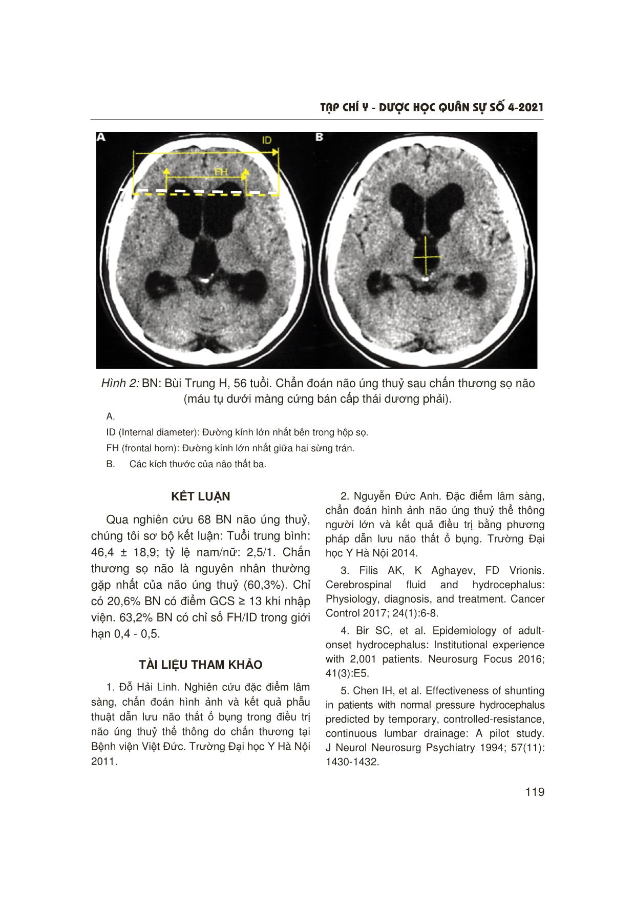 Nghiên cứu đặc điểm dịch tễ, nguyên nhân, triệu chứng lâm sàng và chẩn đoán hình ảnh não úng thuỷ ở người lớn trang 6