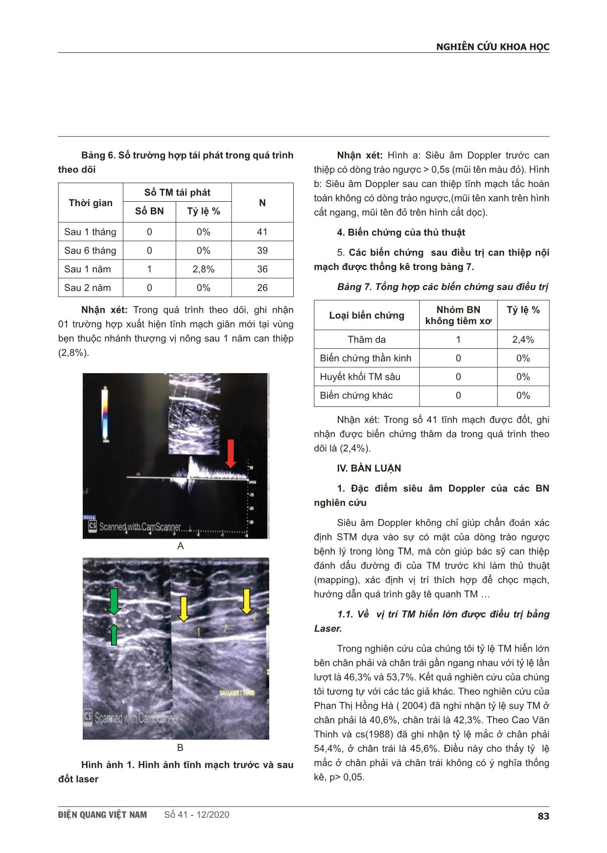 Nghiên cứu đặc điểm hình ảnh siêu âm doppler trước và sau đốt laser nội mạch điều trị suy tĩnh mạch hiển lớn tại bệnh viện Bạch Mai trang 5