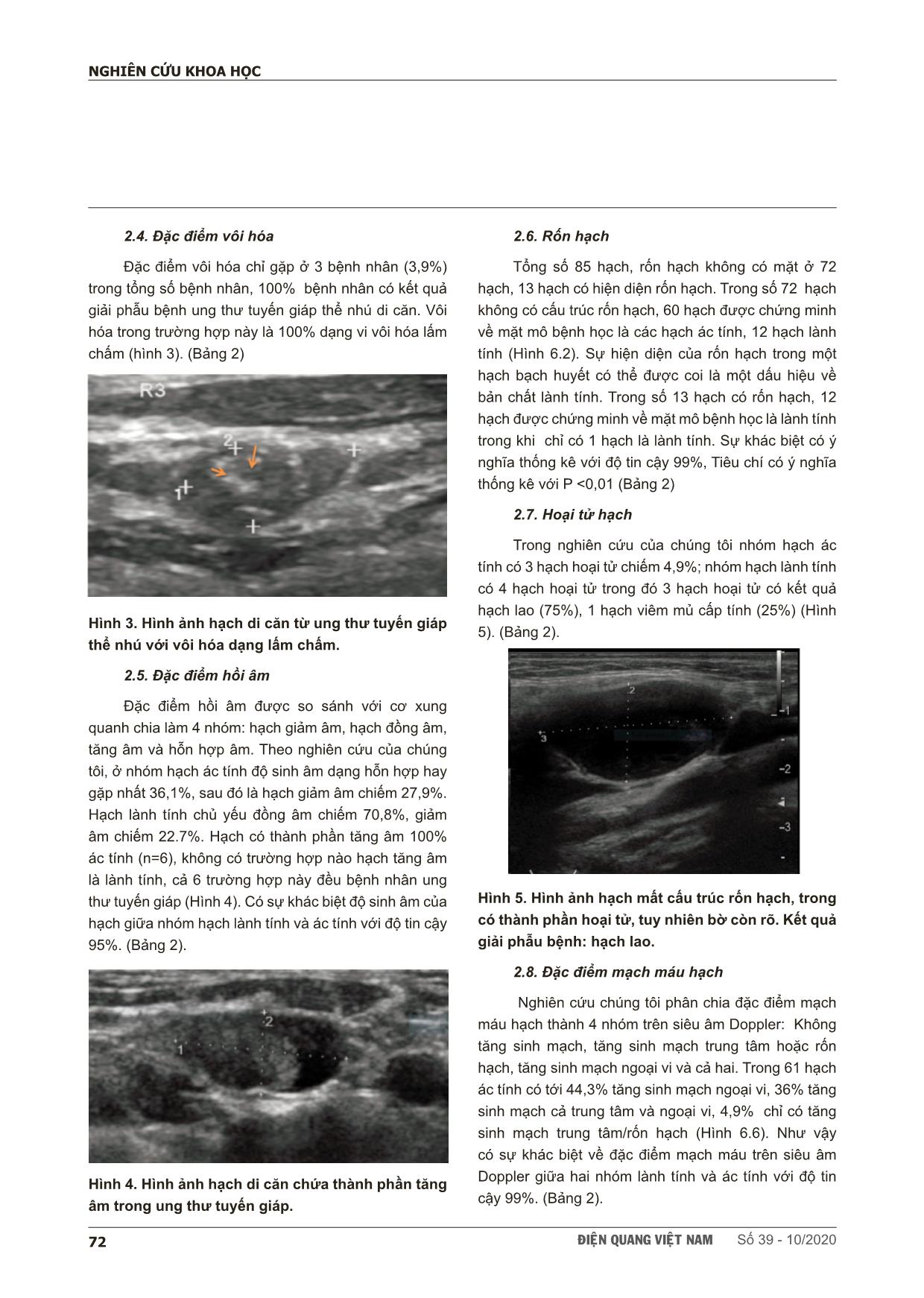 Nghiên cứu đặc điểm hình ảnh và giá trị siêu âm trong chẩn đoán hạch cổ ác tính trang 5