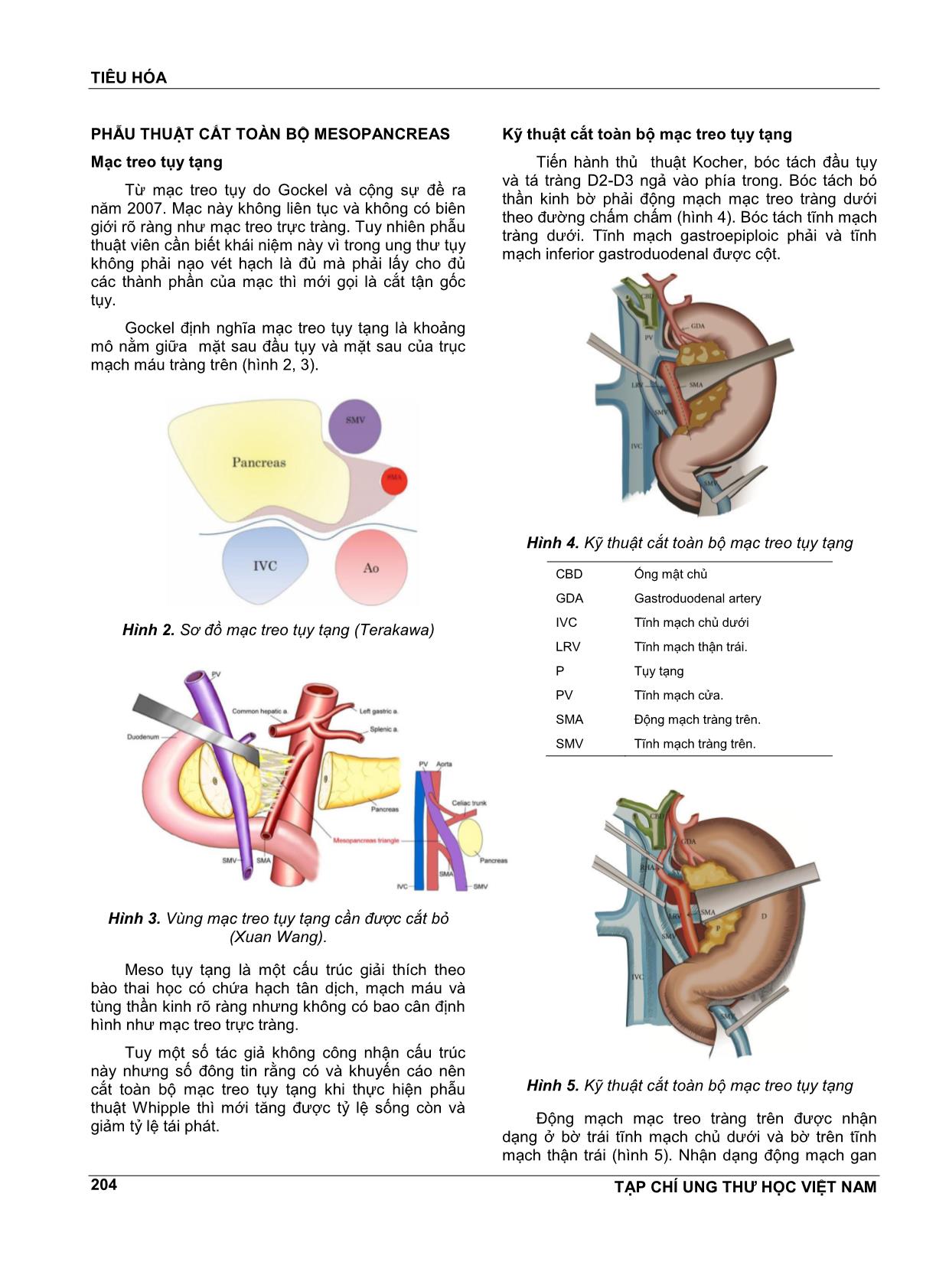 Tiêu hóa: Tiến bộ trong điều trị ngoại khoa ung thư tụy tạng trang 4