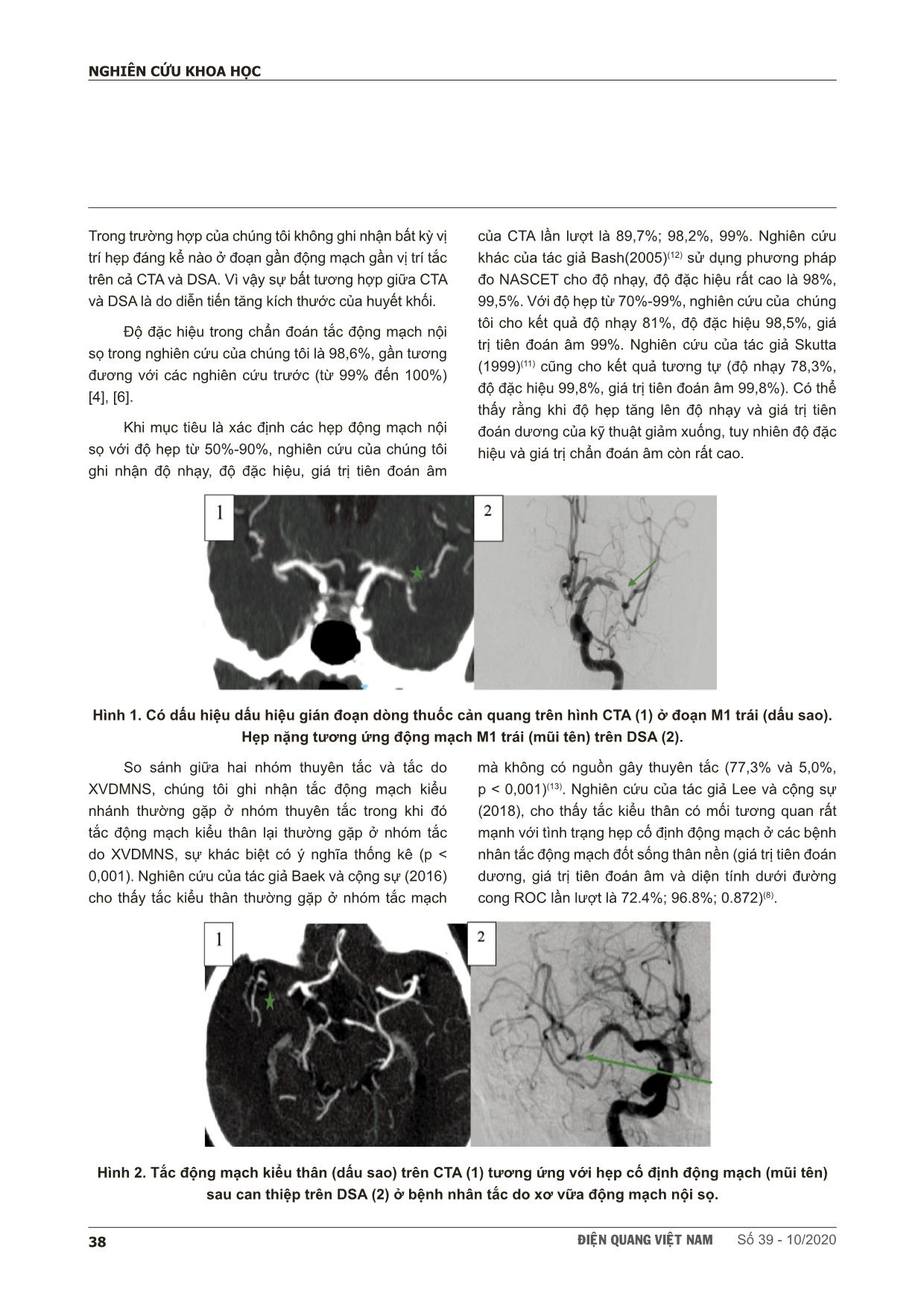 Vai trò của chụp cắt lớp vi tính mạch máu trong chẩn đoán hẹp tắc động mạch nội sọ ở bệnh nhân đột quỵ do thiếu máu não cấp trang 4