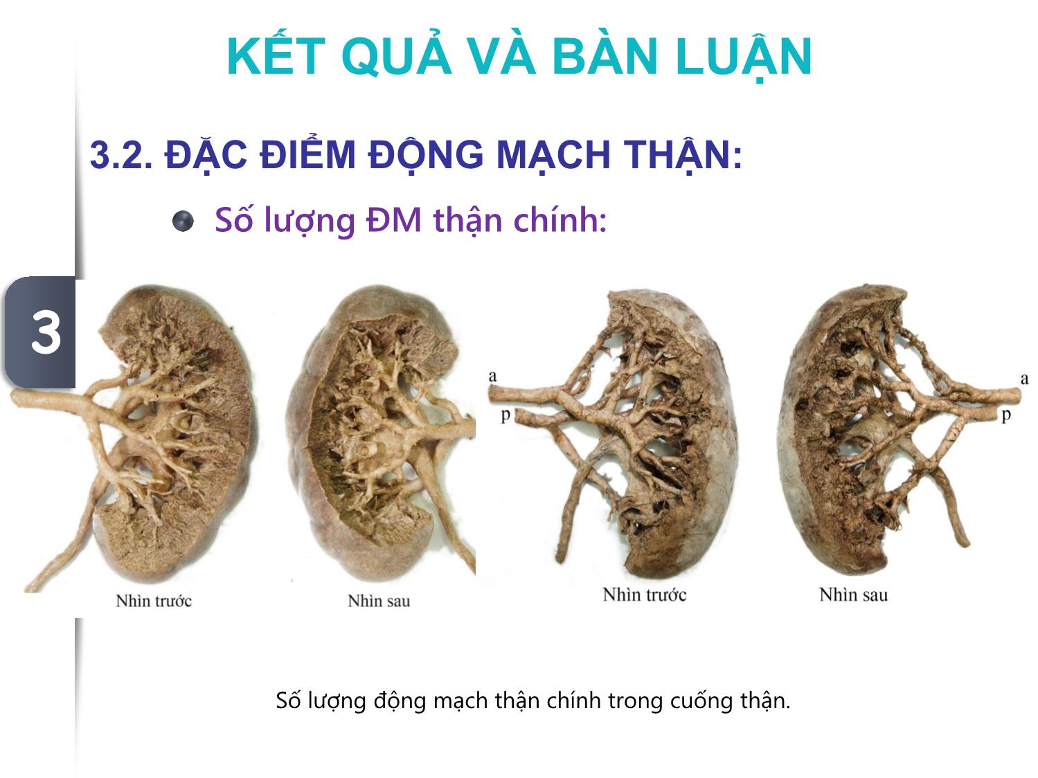 Một số đặc điểm giải phẫu động mạch thận đoạn ngoài nhu mô ở người Việt Nam trang 8