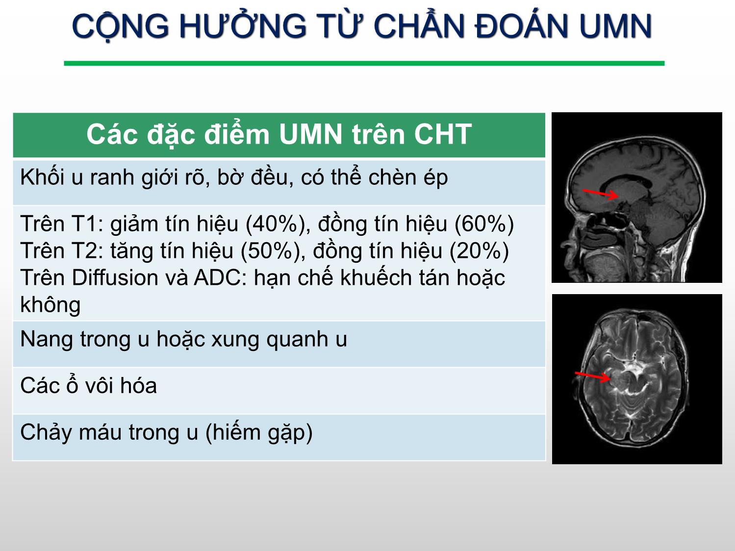 Đặc điểm hình ảnh cộng hưởng từ u màng não nền sọ ở bệnh nhân điều trị bằng dao gamma quay tại bệnh viện Bạch Mai trang 6
