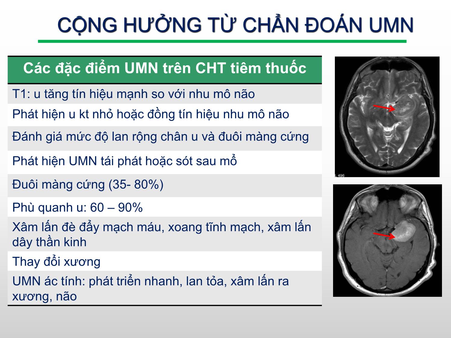 Đặc điểm hình ảnh cộng hưởng từ u màng não nền sọ ở bệnh nhân điều trị bằng dao gamma quay tại bệnh viện Bạch Mai trang 7
