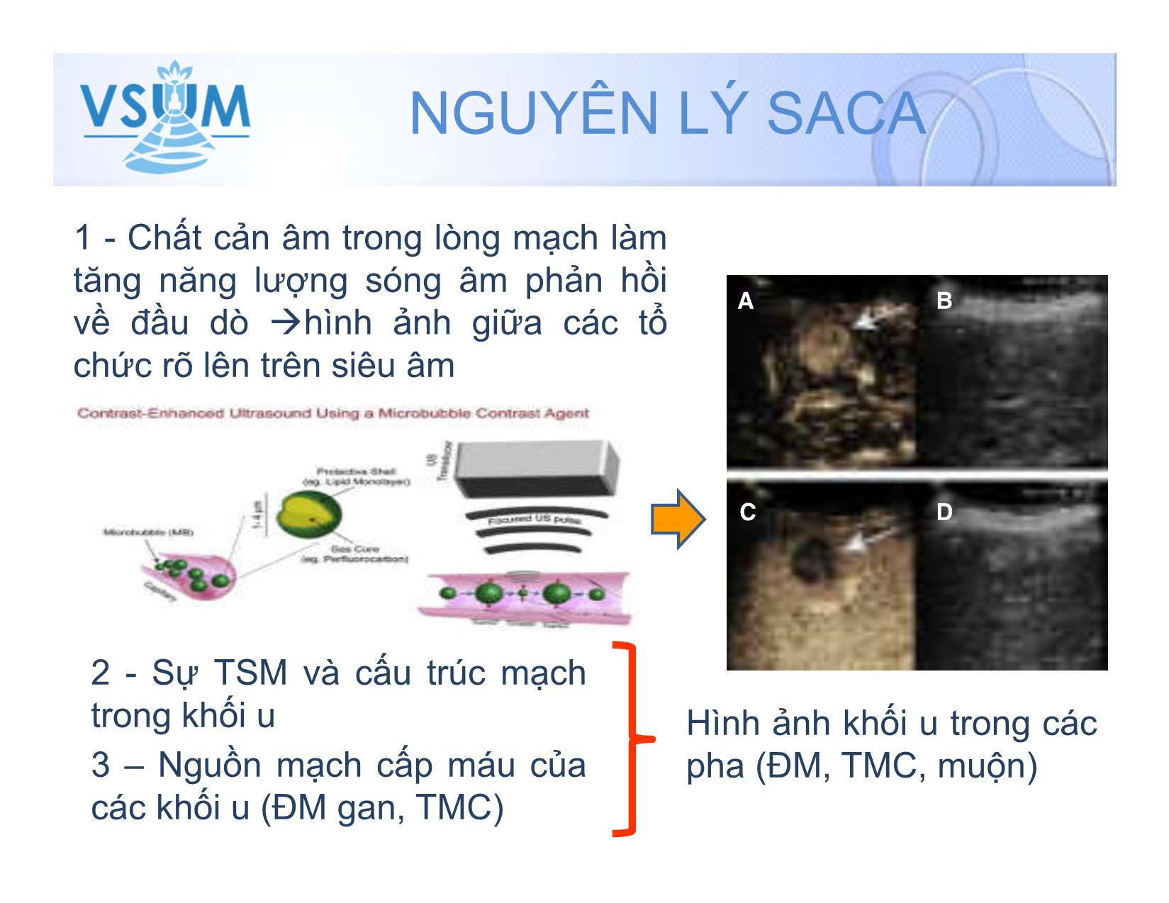 Đặc điểm hình ảnh của ung thư biểu mô tế bào gan trên siêu âm cản âm trang 6