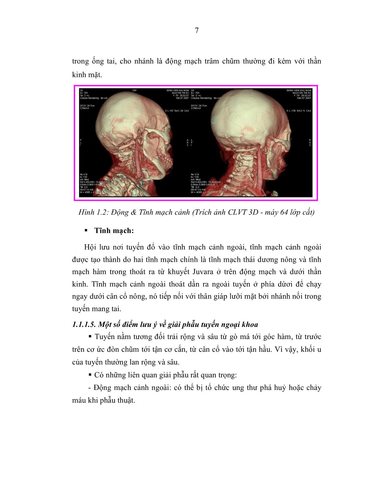 Nghiên cứu chẩn đoán và điều trị phẫu thuật u tuyến nước bọt mang tai trang 7