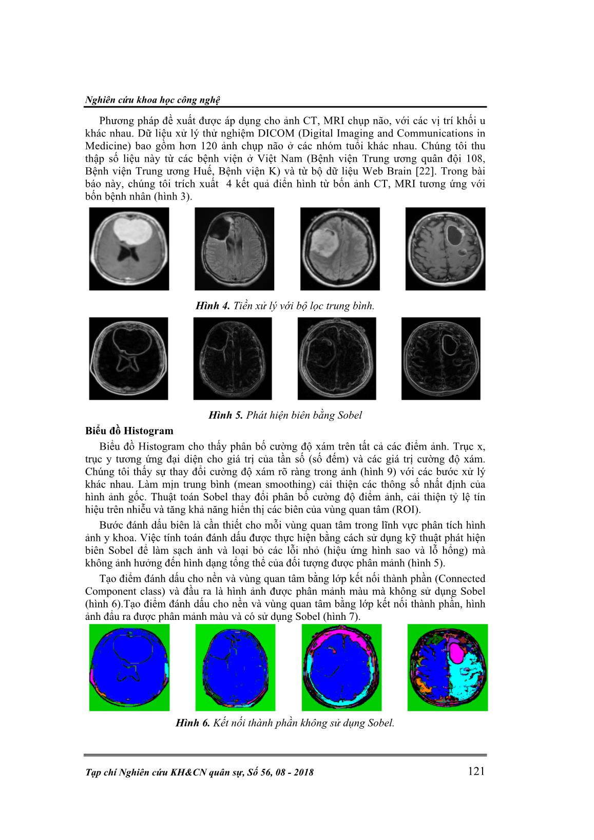 Phát hiện và phân tách khối u não sử dụng phương pháp định biên và phát triển vùng trang 7