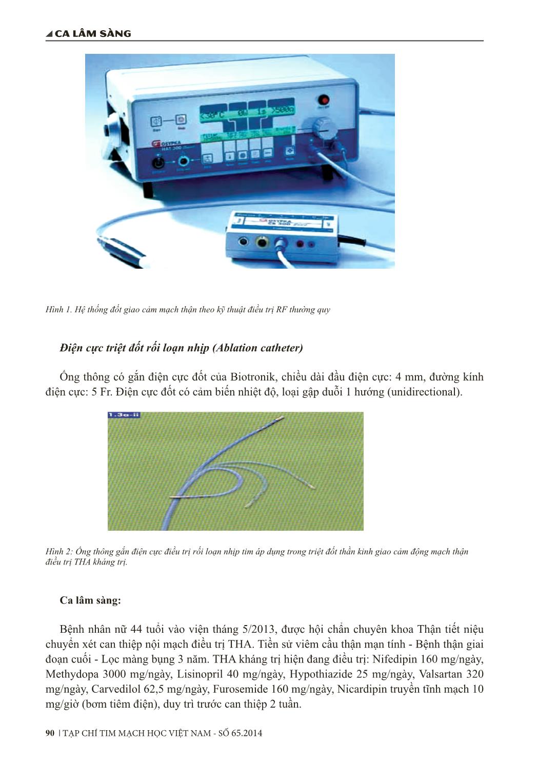 Triệt đốt thần kinh giao cảm động mạch thận bằng năng lượng sóng tần số radio điều trị tăng huyết áp kháng trị trên một trường hợp bệnh thận giai đoạn cuối trang 2