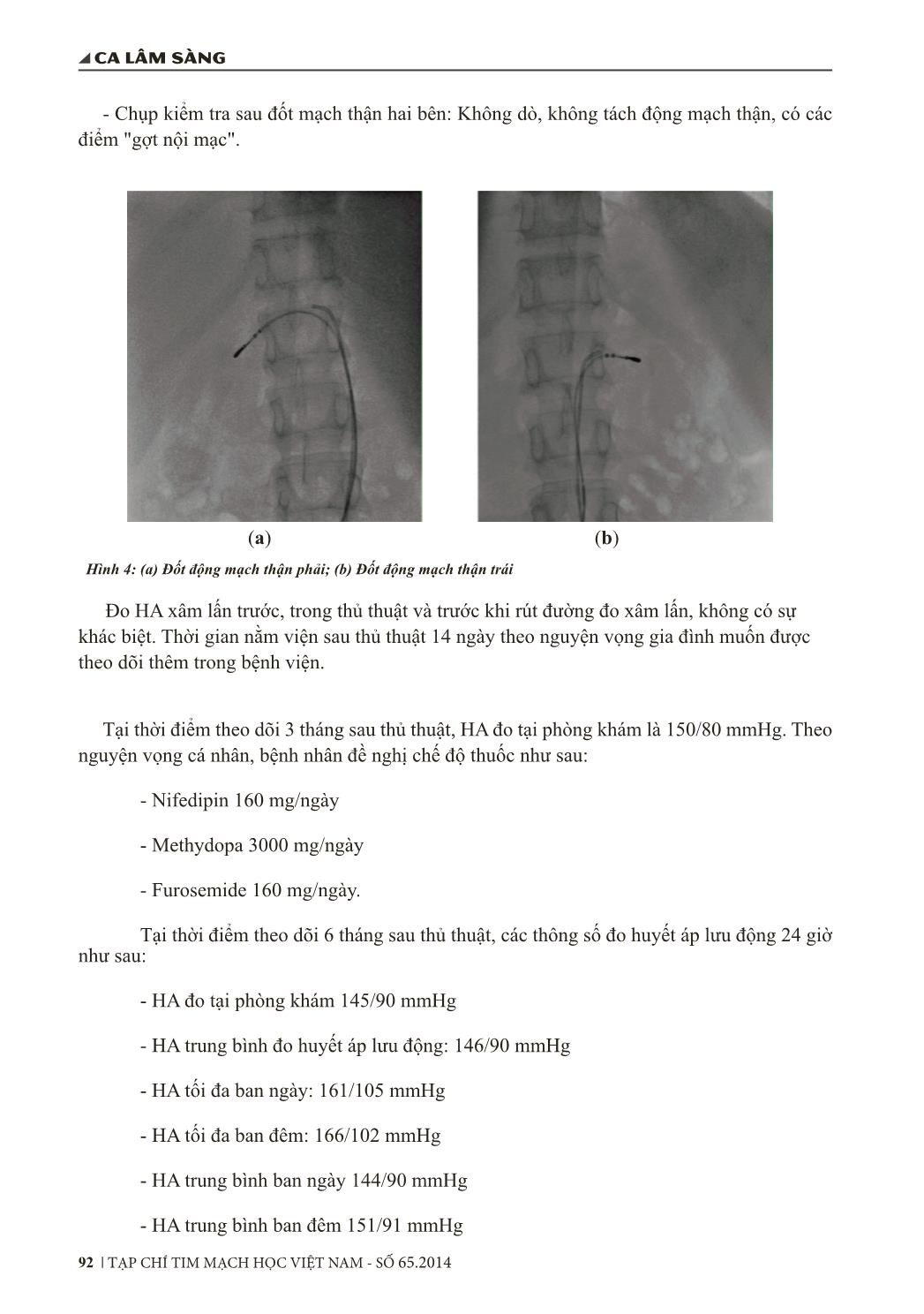 Triệt đốt thần kinh giao cảm động mạch thận bằng năng lượng sóng tần số radio điều trị tăng huyết áp kháng trị trên một trường hợp bệnh thận giai đoạn cuối trang 4