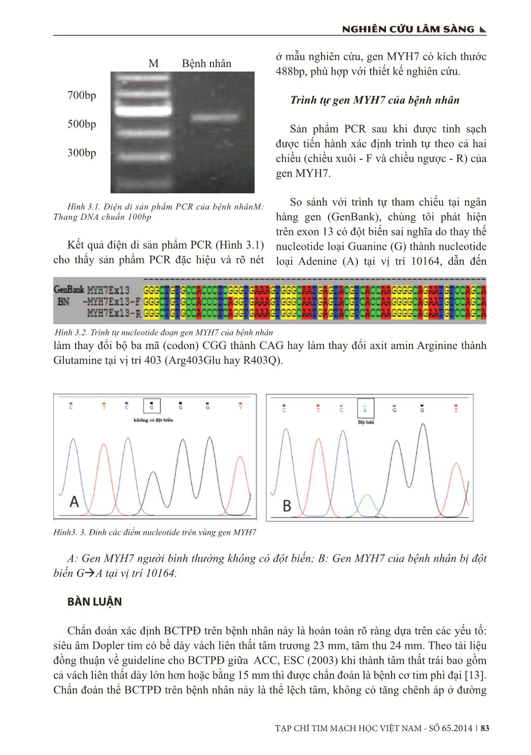 Phát hiện đột biến gen tổng hợp chuỗi nặng Beta - Myosin (MYH7) trong bệnh cơ tim phì đại trang 4