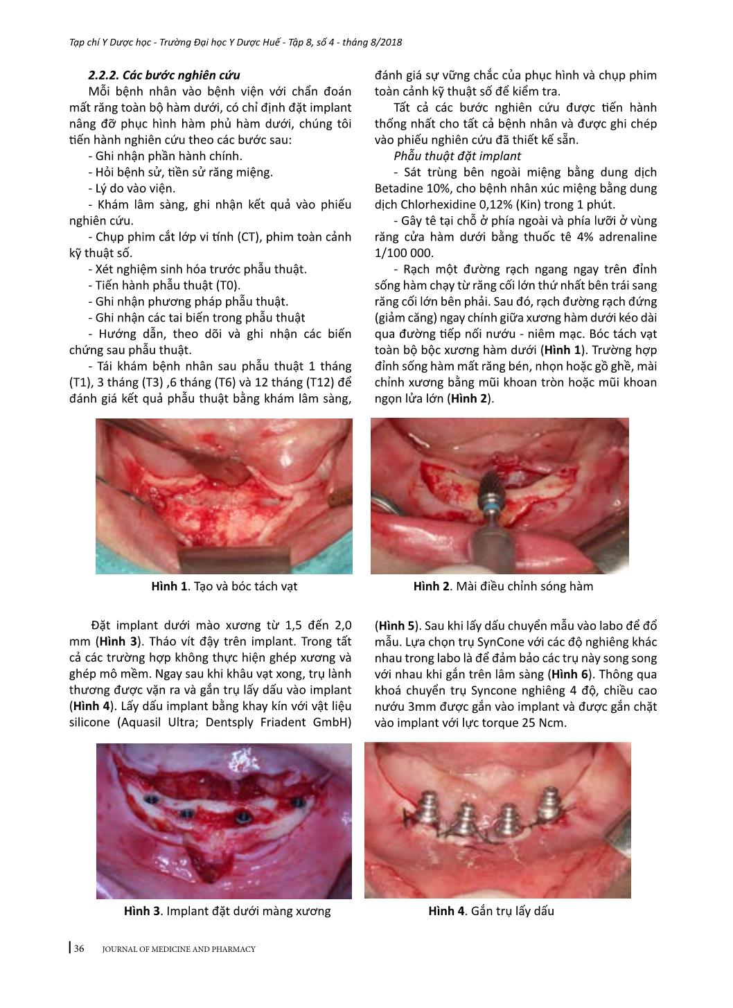 Đánh giá hiệu quả của hàm phủ trên implant chịu lực tức thì với kết nối chụp lồng trong điều trị mất răng toàn bộ hàm dưới trang 3