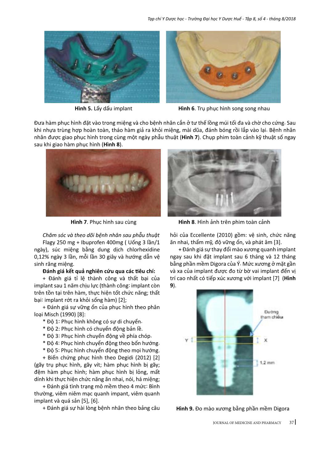 Đánh giá hiệu quả của hàm phủ trên implant chịu lực tức thì với kết nối chụp lồng trong điều trị mất răng toàn bộ hàm dưới trang 4