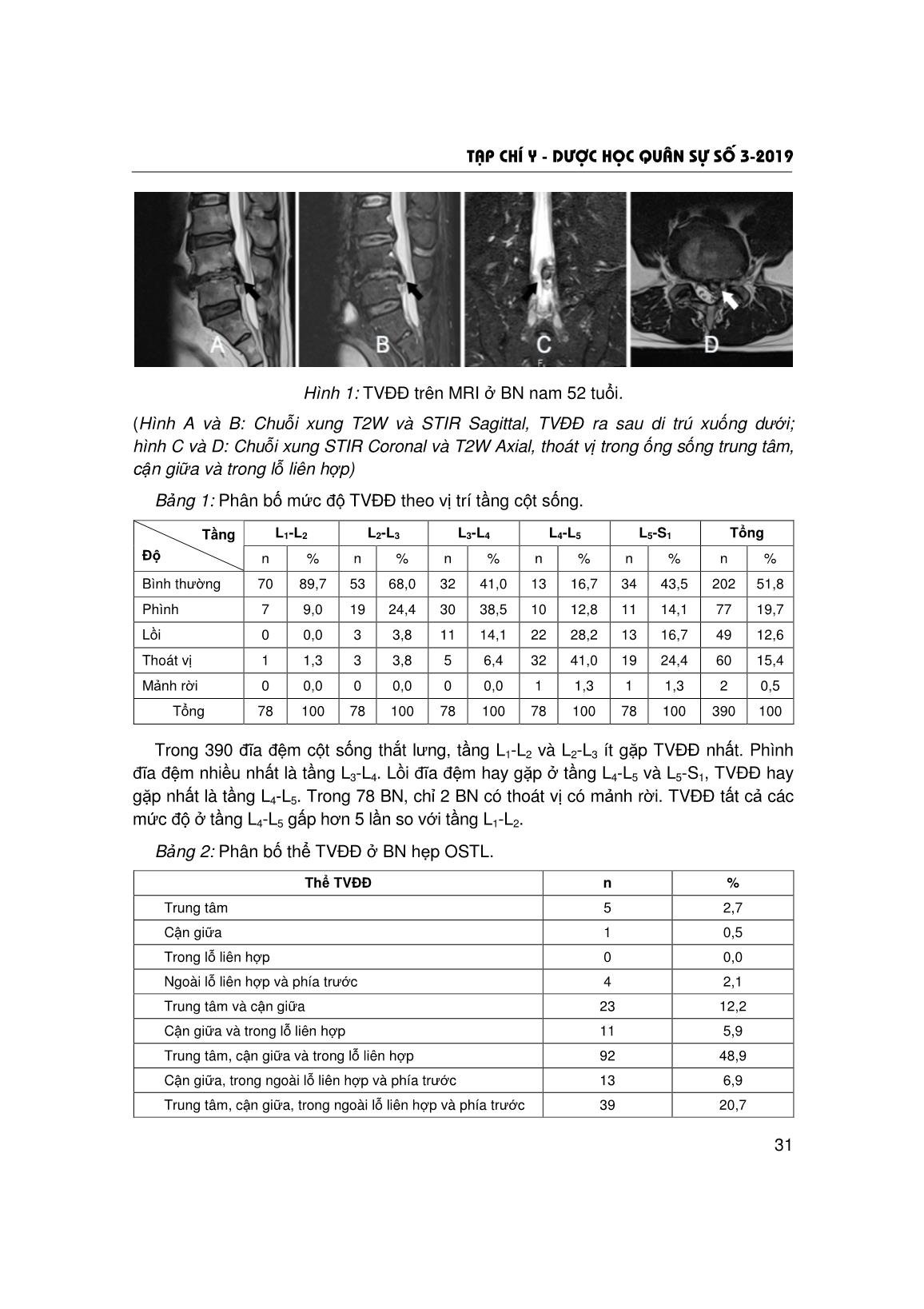 Hẹp ống sống thắt lưng do thoát vị đĩa đệm trên hình ảnh cộng hưởng từ trang 4