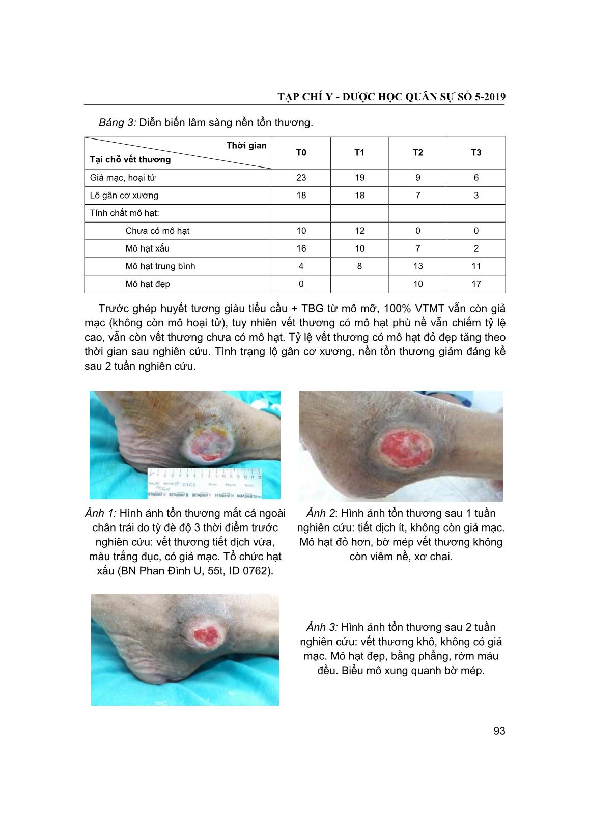 Nghiên cứu hiệu quả của huyết tương giàu tiểu cầu phối hợp với tế bào gốc từ mô mỡ tự thân trong điều trị vết thương mạn tính trang 5