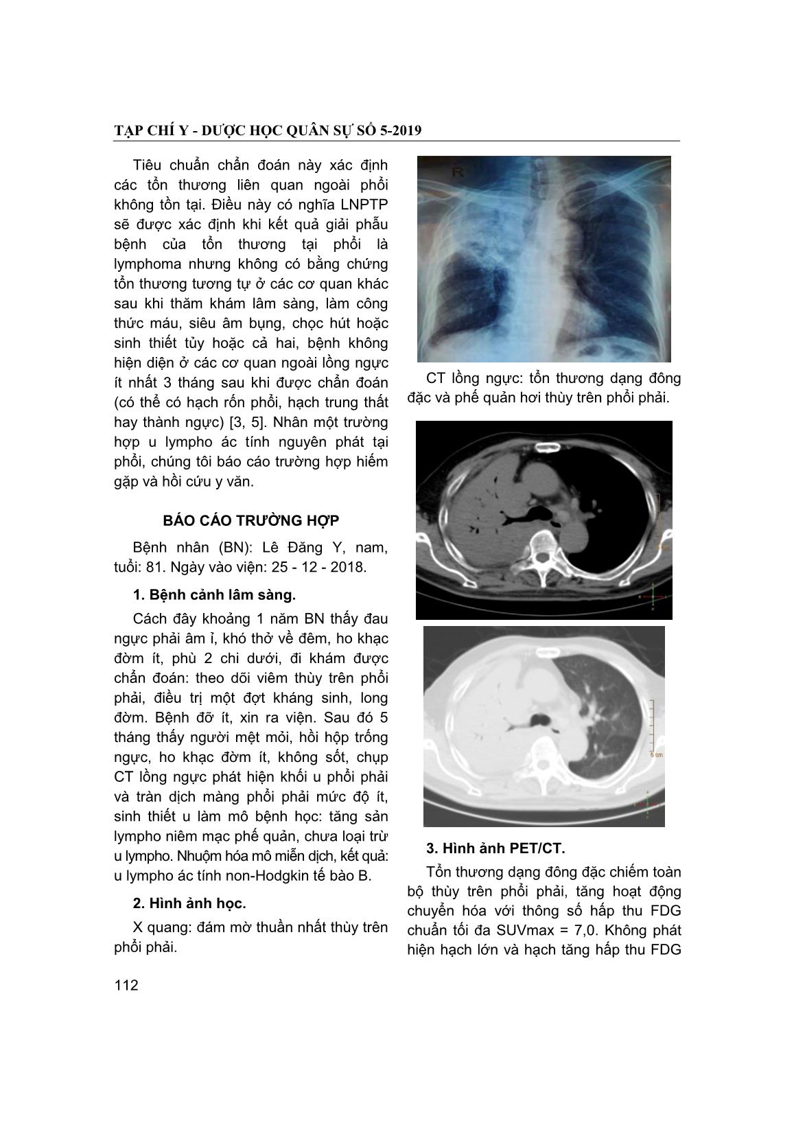 Lymphoma nguyên phát tại phổi: Báo cáo một trường hợp và hồi cứu y văn trang 2