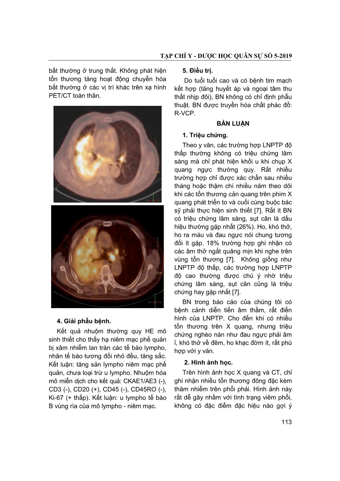 Lymphoma nguyên phát tại phổi: Báo cáo một trường hợp và hồi cứu y văn trang 3