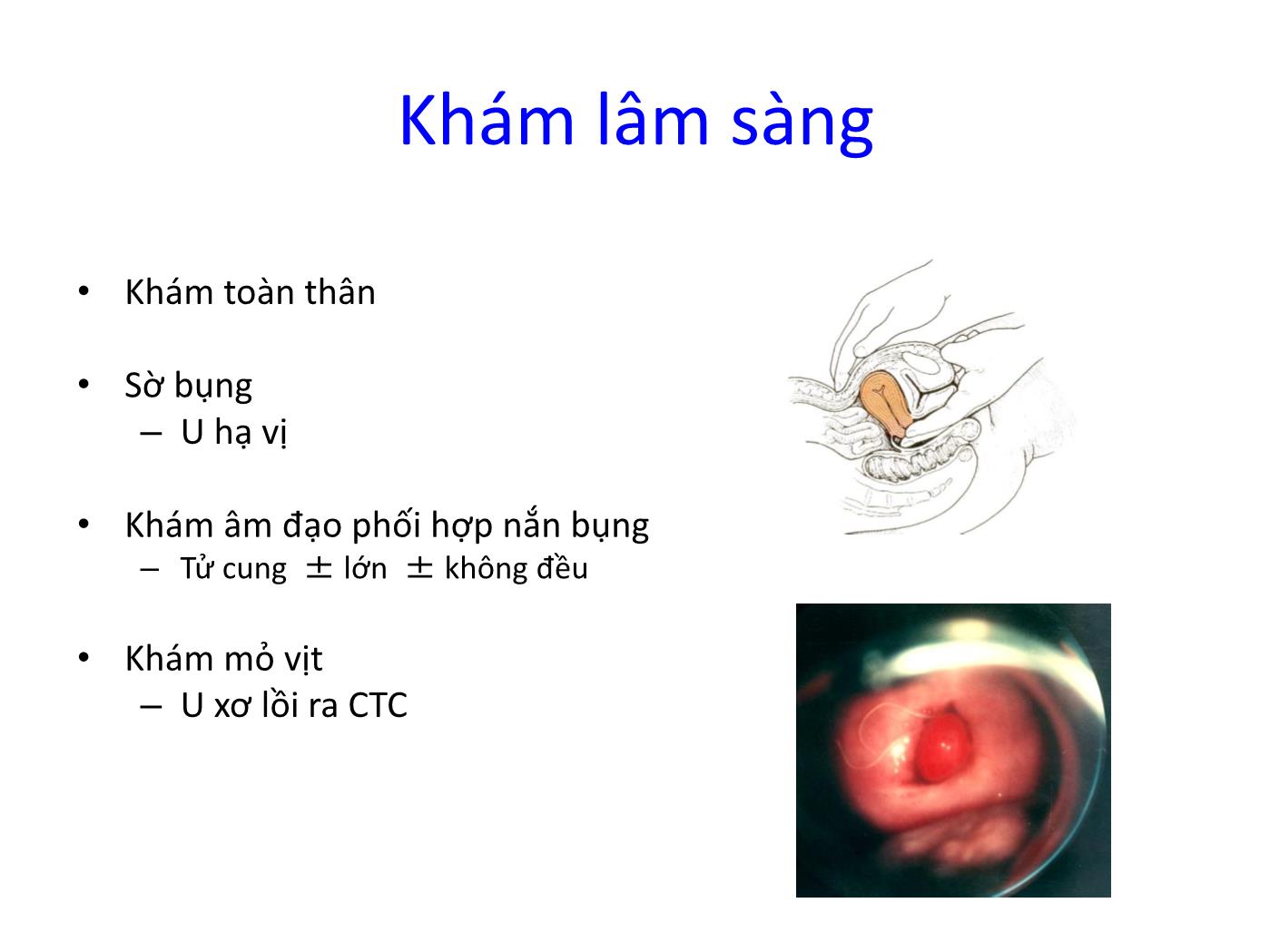 Bài giảng Bệnh học cơ tử cung trang 7