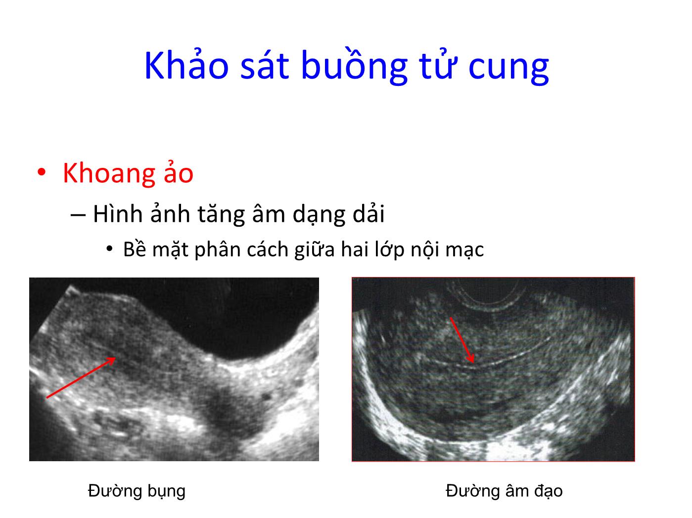 Bài giảng Bệnh lý nội mạc trang 4