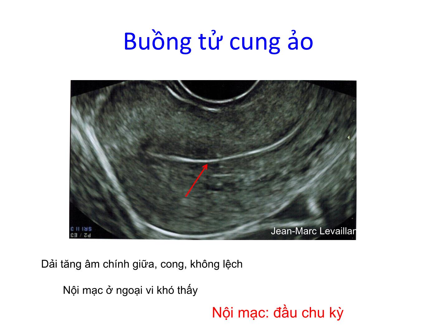 Bài giảng Bệnh lý nội mạc trang 5