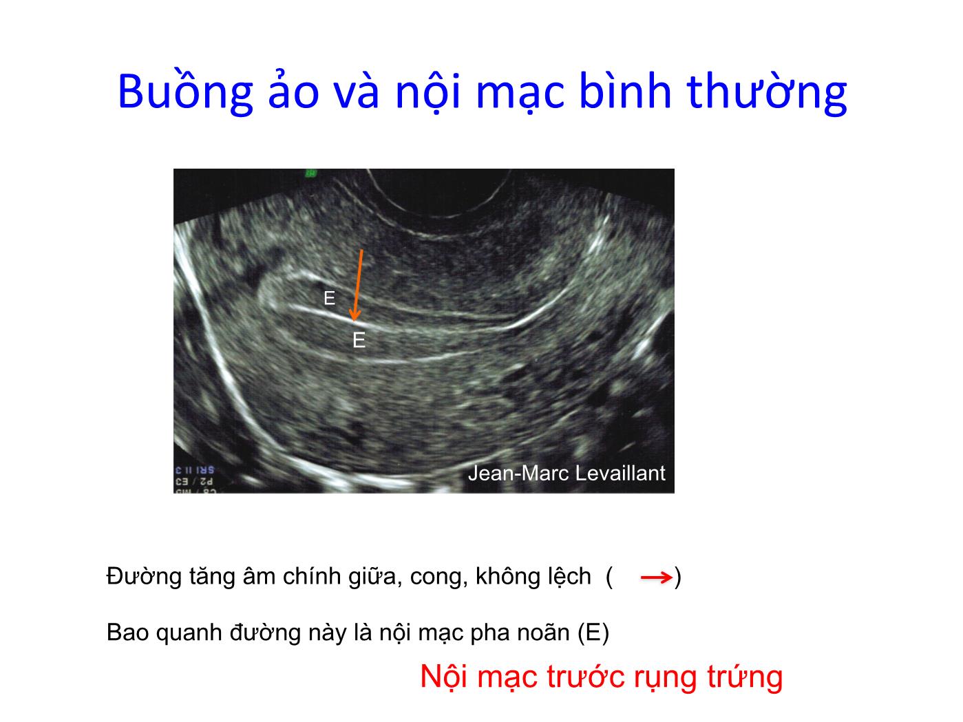 Bài giảng Bệnh lý nội mạc trang 6