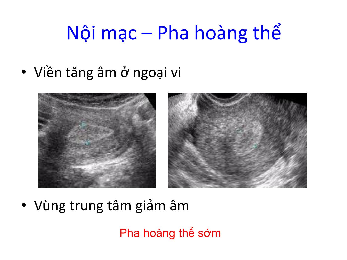 Bài giảng Bệnh lý nội mạc trang 8