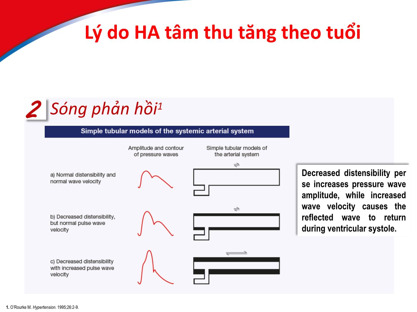 Bài giảng Điều trị tăng huyết áp ở bệnh nhân cao tuổi - Hồ Huỳnh Quang Trí trang 8