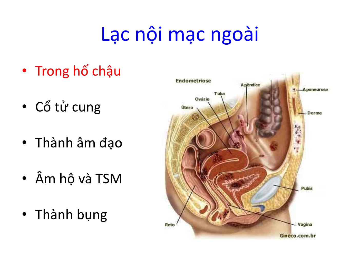 Bài giảng Lạc nội mạc ngoài tử cung trang 2