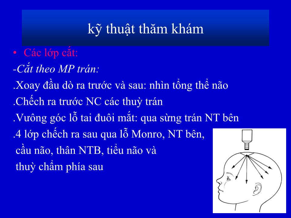 Bài giảng Siêu âm qua thóp - Phạm Minh Thông trang 6