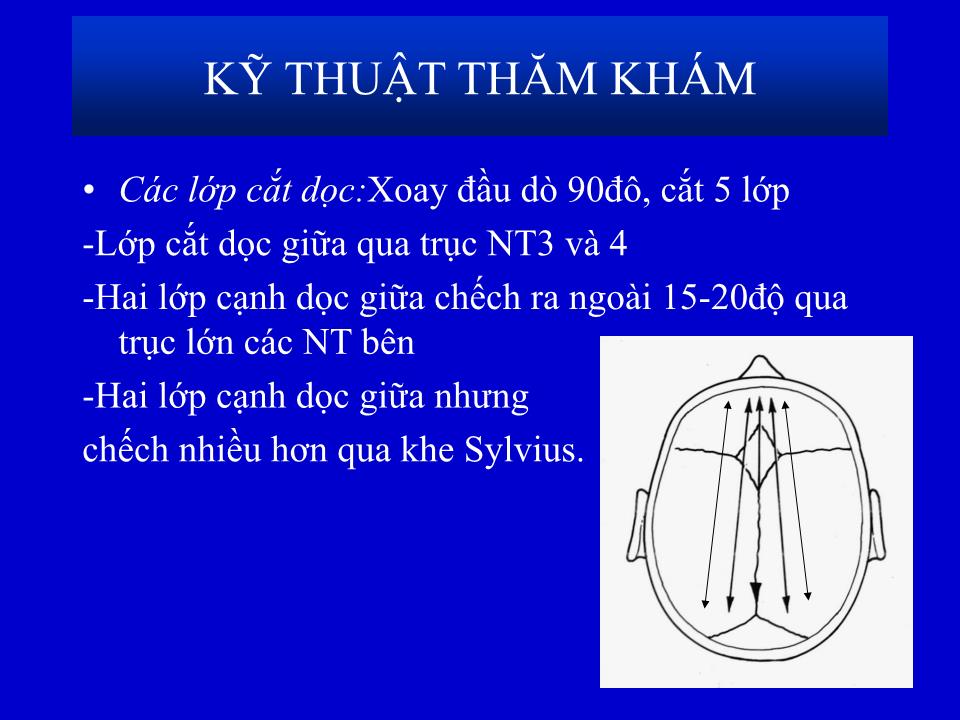 Bài giảng Siêu âm qua thóp - Phạm Minh Thông trang 7