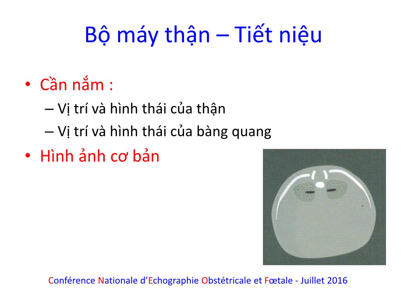 Bài giảng Hệ tiết niệu trang 3