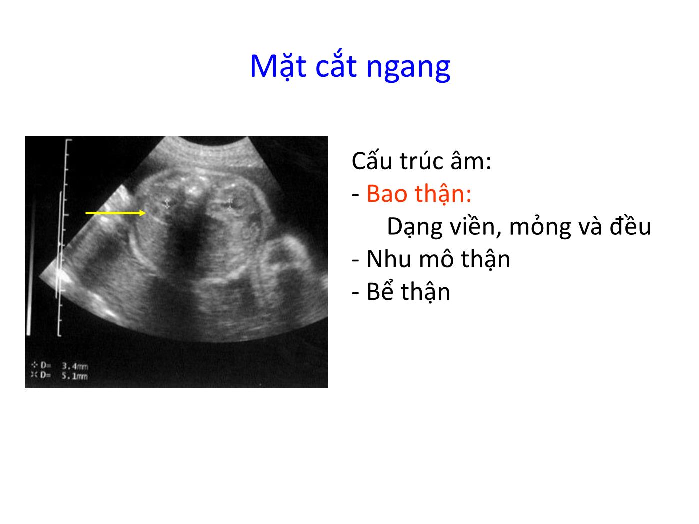 Bài giảng Hệ tiết niệu trang 7