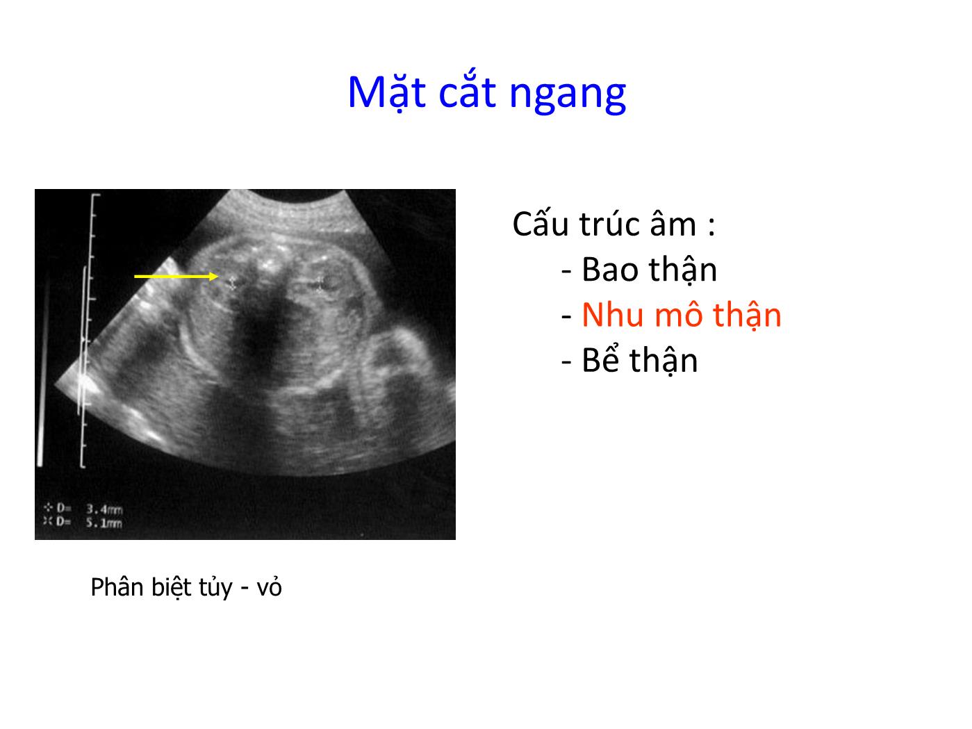 Bài giảng Hệ tiết niệu trang 8