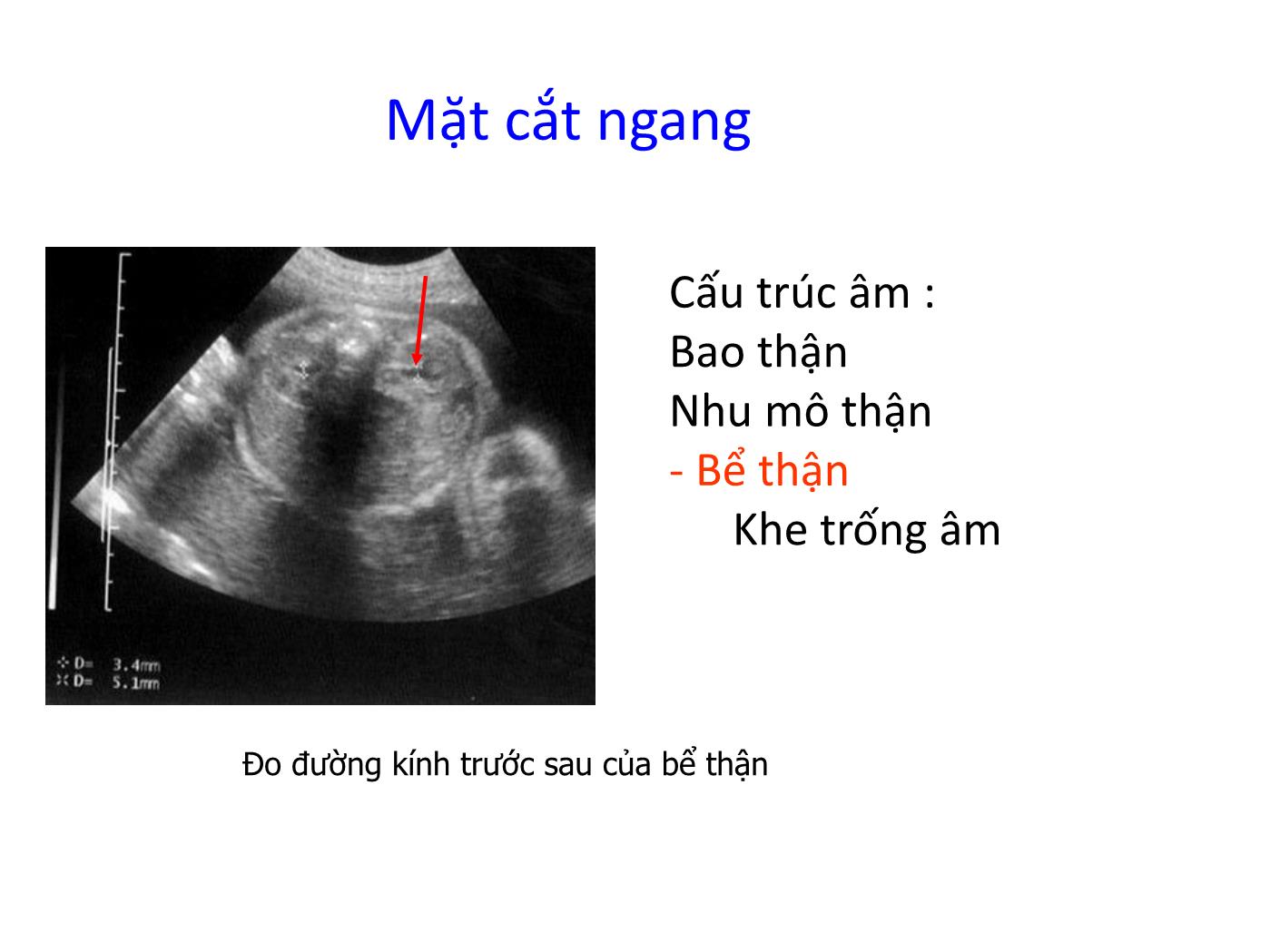 Bài giảng Hệ tiết niệu trang 9