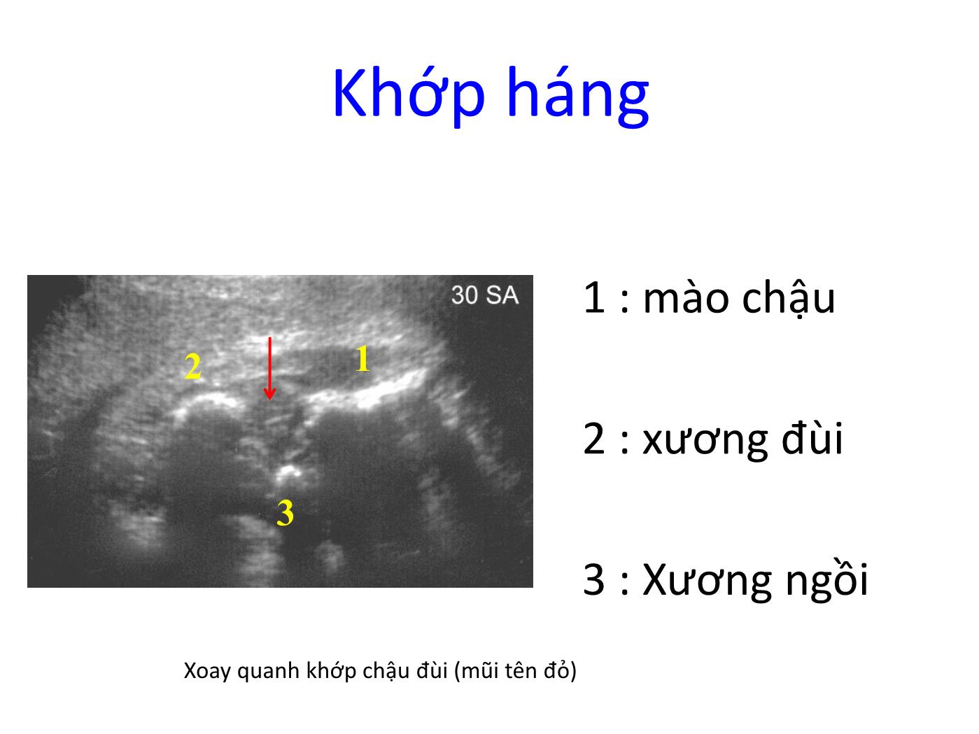 Hình ảnh siêu âm bình thường các chi trang 7