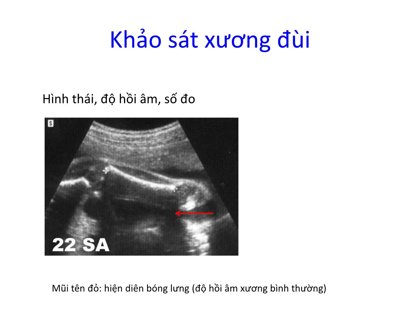 Hình ảnh siêu âm bình thường các chi trang 8