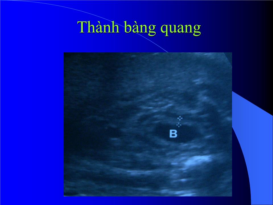 Bài giảng Bất thường hệ niệu - Hà Tố Nguyên trang 10