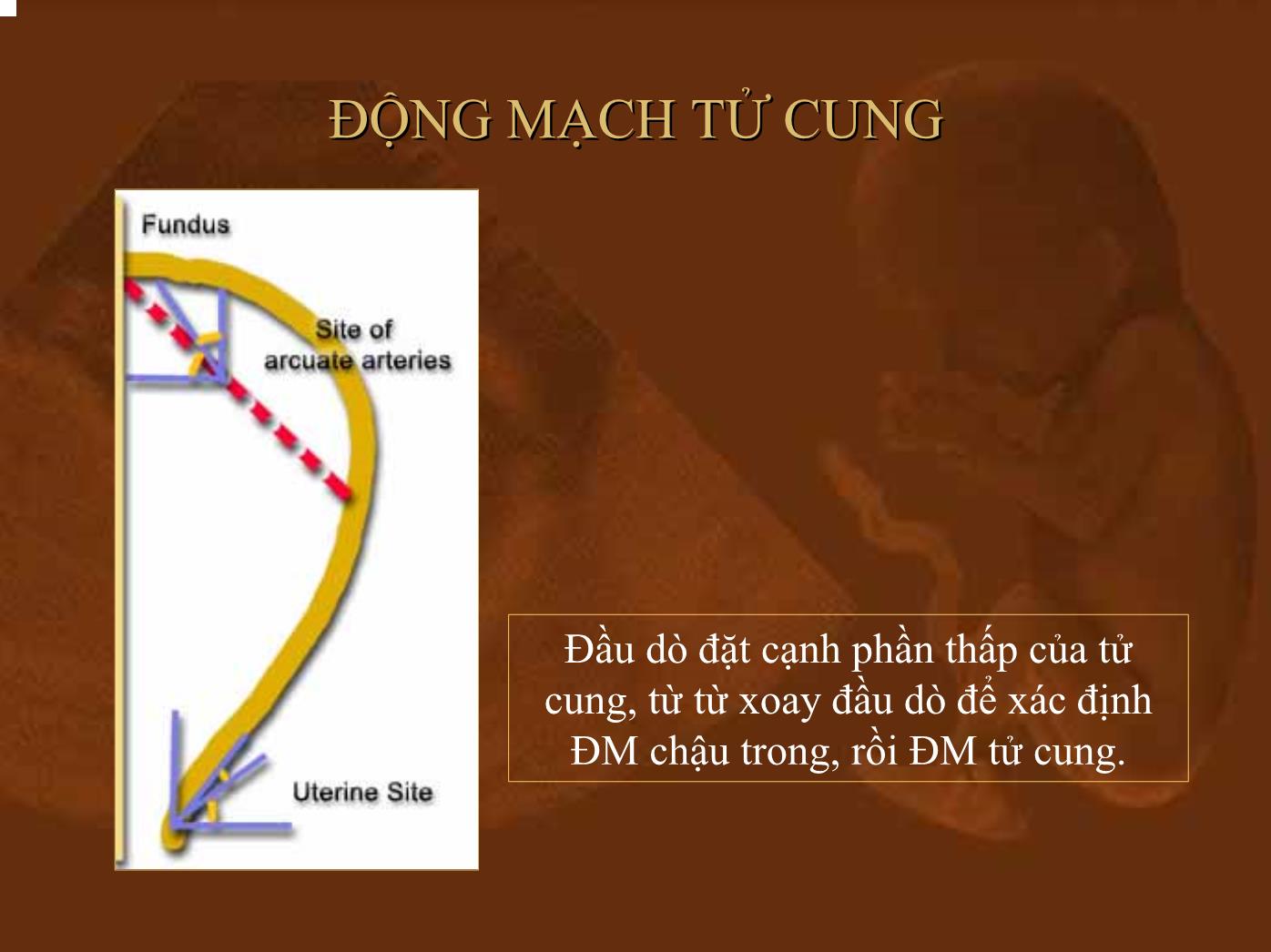 Bài giảng Doppler ứng dụng trong sản phụ khoa - Nguyễn Quang Trọng trang 5