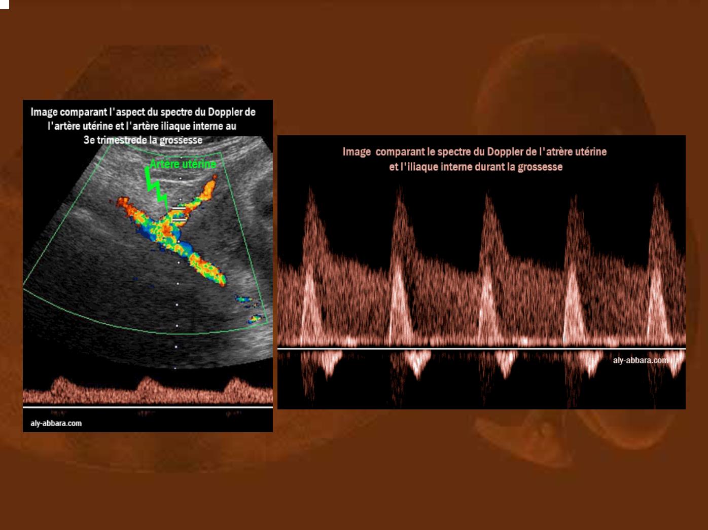 Bài giảng Doppler ứng dụng trong sản phụ khoa - Nguyễn Quang Trọng trang 8