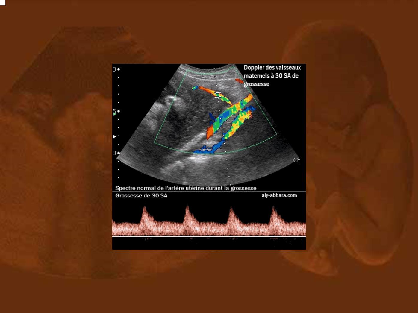 Bài giảng Doppler ứng dụng trong sản phụ khoa - Nguyễn Quang Trọng trang 9